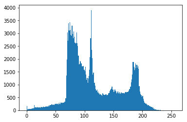 ../_images/sec01-histogram-begins_6_0.png