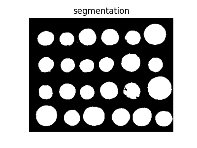 segmentation