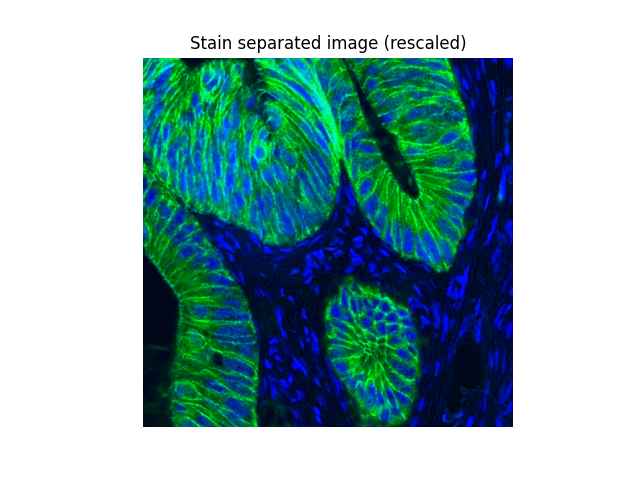 Stain separated image (rescaled)