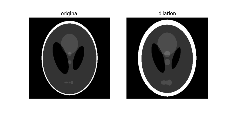 original, dilation