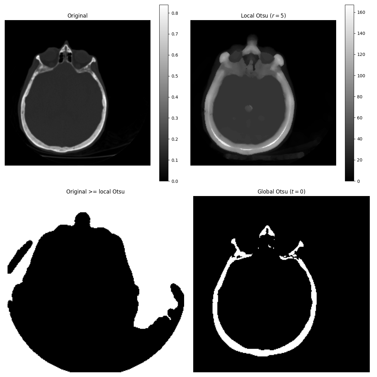 Original, Local Otsu ($r=5$), Original >= local Otsu, Global Otsu ($t=0$)